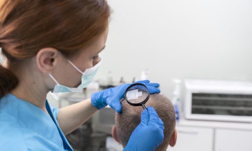 adult-male-having-balding-problems