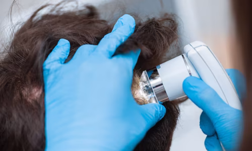 diagnosis-diseases-scalp-by-trichologist_97875-572