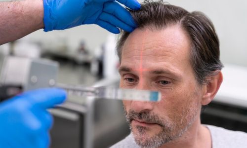 man-getting-hair-loss-treatment_23-2149152765