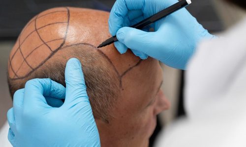 portfolio-img3-1400x700