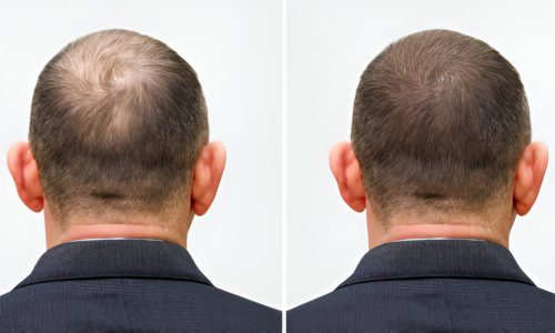 steptodown.com178142