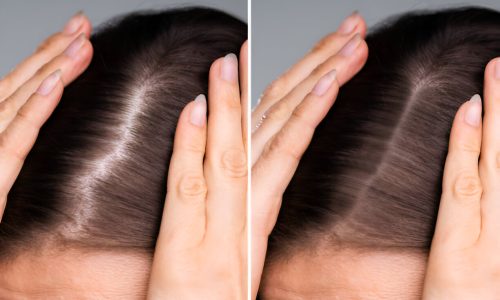 steptodown.com236938