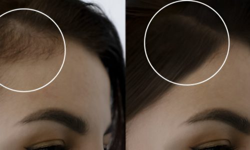 steptodown.com272544