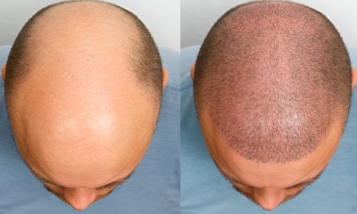 steptodown.com607999