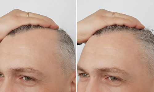 steptodown.com805501